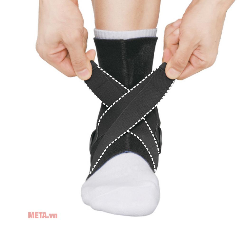 X‑Strap cung cấp lực nén đa hướng