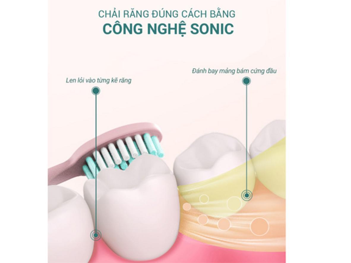 Công nghệ sóng âm 31.000 nhịp/phút