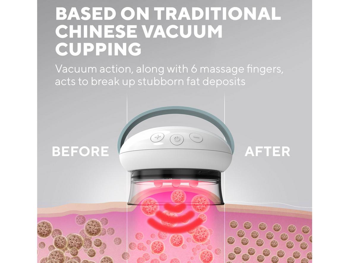 Trị liệu nóng lạnh kết hợp nhiệt hồng ngoại